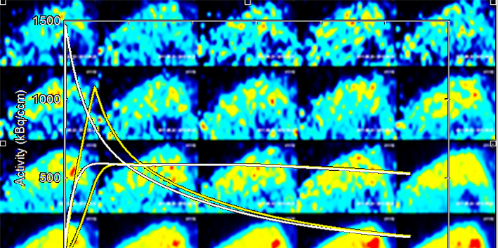Enlarged view: PET kinetic modelling